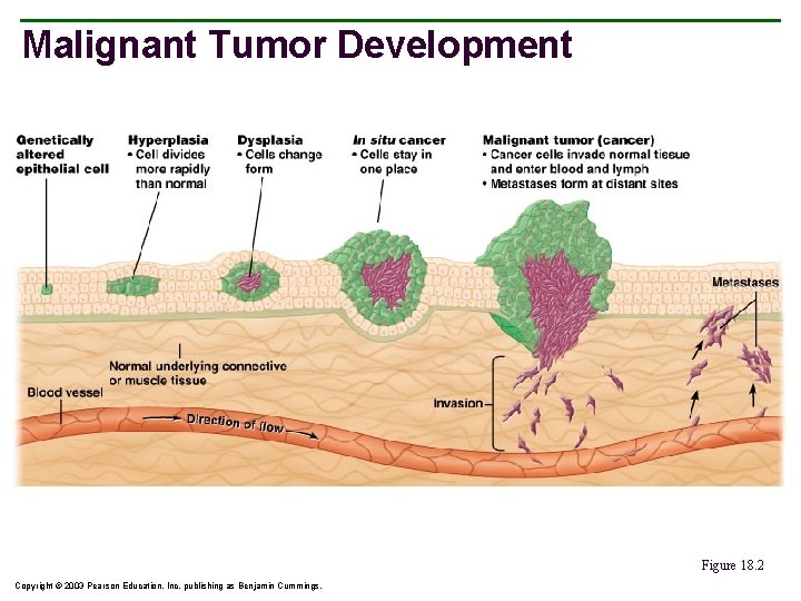 Malignant Tumor Development Figure 18. 2 Copyright © 2003 Pearson Education, Inc. publishing as
