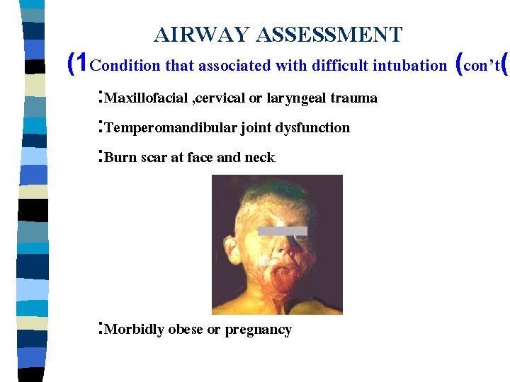 AIRWAY ASSESSMENT (1 Condition that associated with difficult intubation (con’t( : Maxillofacial , cervical