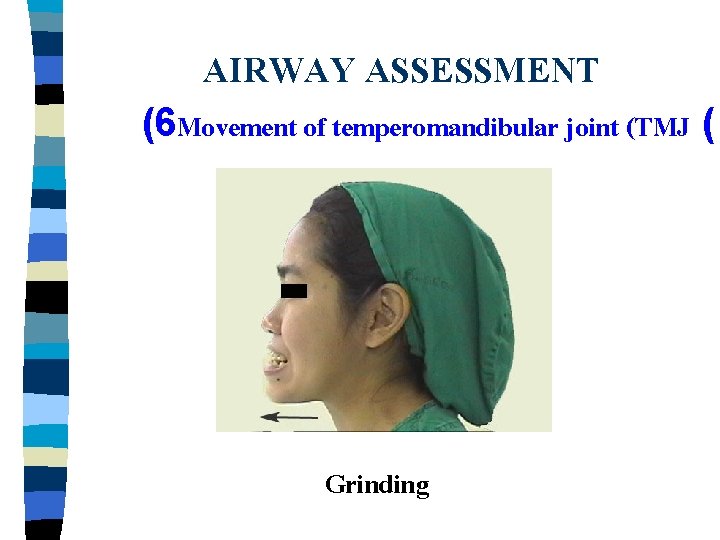 AIRWAY ASSESSMENT (6 Movement of temperomandibular joint (TMJ ( Grinding 