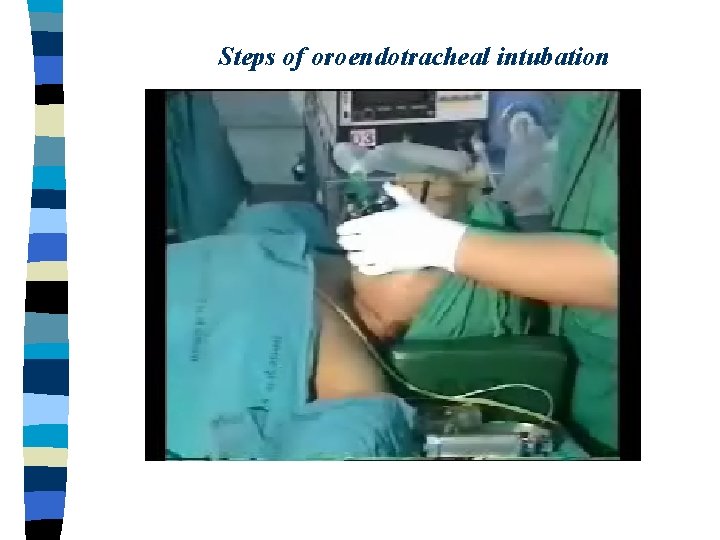 Steps of oroendotracheal intubation 