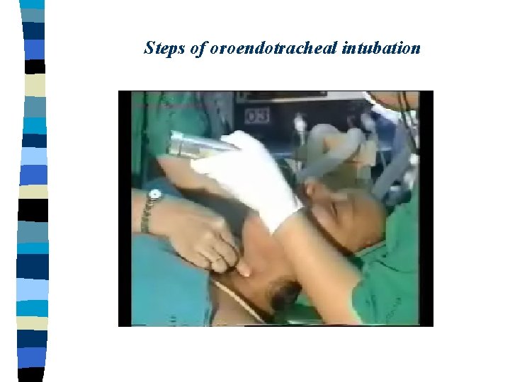 Steps of oroendotracheal intubation 