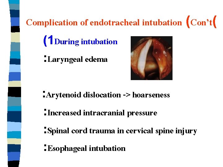 ENDOTRACHEAL INTUBATION Thida Uakritdathikarn MD Department Of