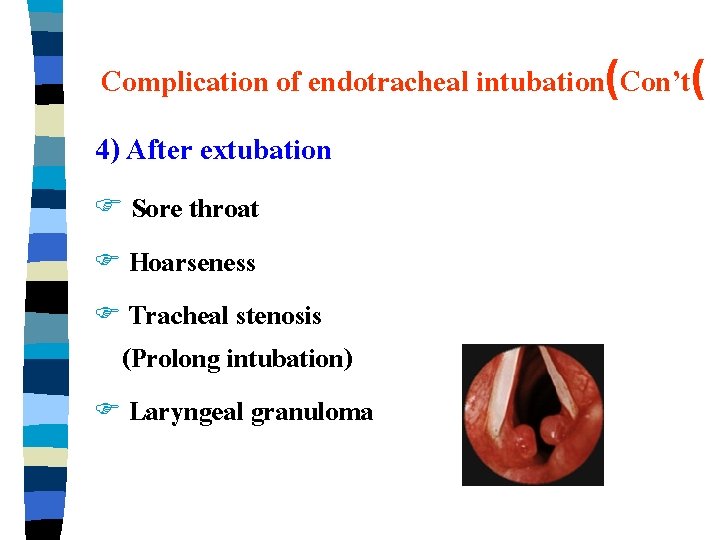 Complication of endotracheal intubation(Con’t( 4) After extubation F Sore throat F Hoarseness F Tracheal