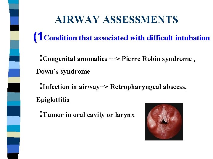 AIRWAY ASSESSMENTS (1 Condition that associated with difficult intubation : Congenital anomalies ---> Pierre