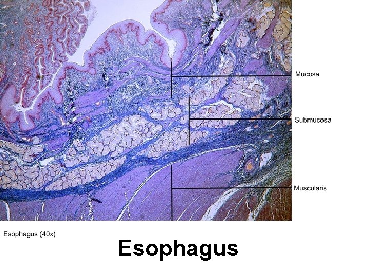 Esophagus 