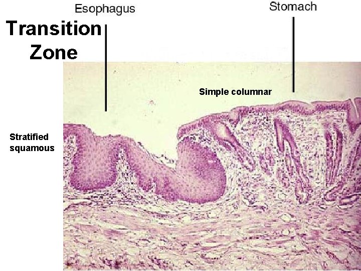 Transition Zone Simple columnar Stratified squamous 