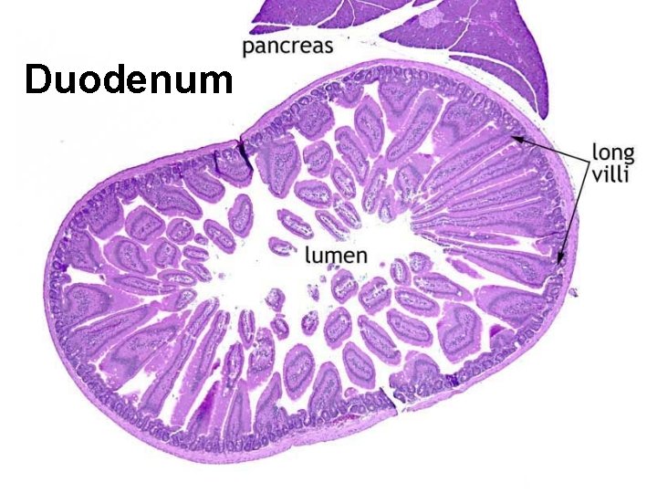 Duodenum 