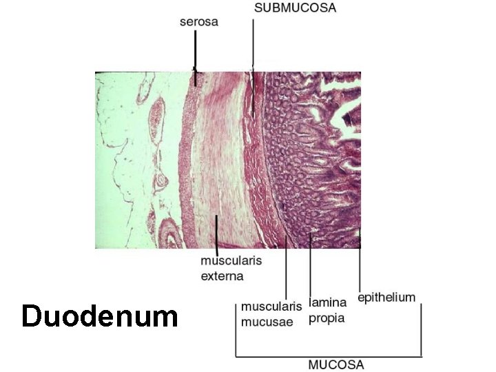 Duodenum 