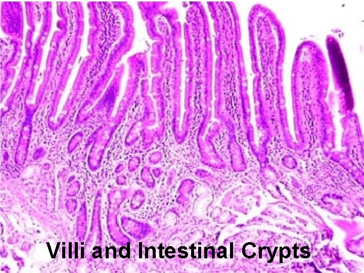 Villi and Intestinal Crypts 