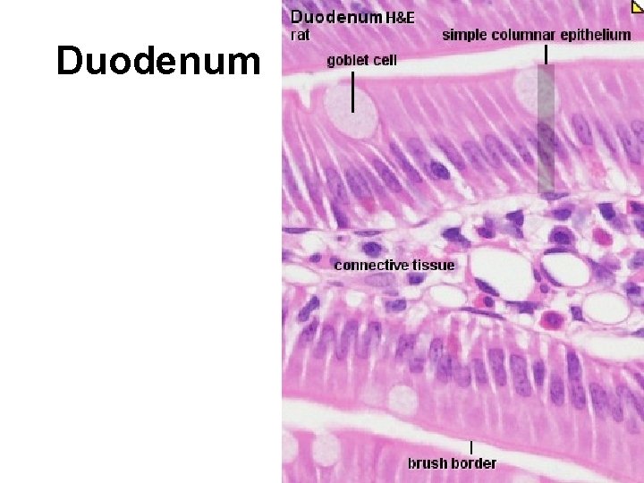 Duodenum 