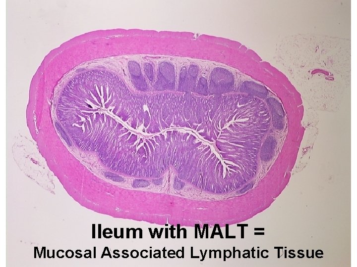 Ileum with MALT = Mucosal Associated Lymphatic Tissue 