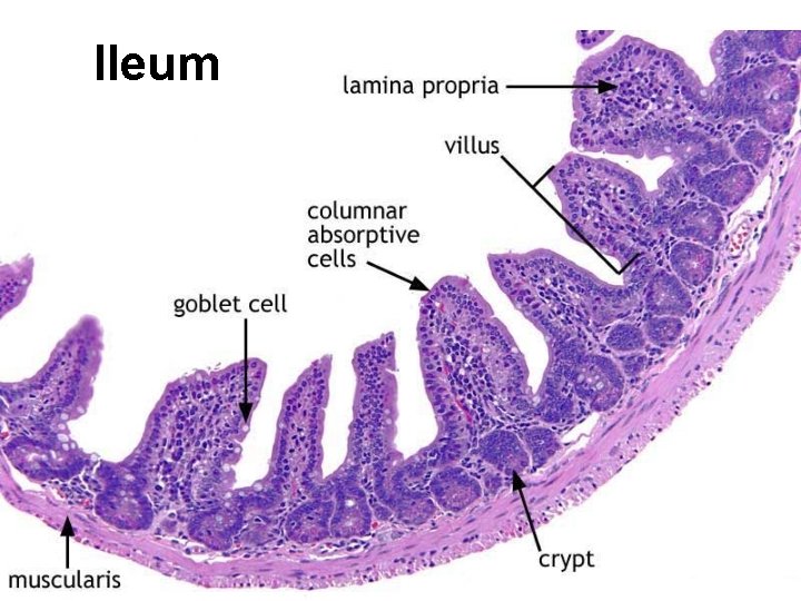 Ileum 