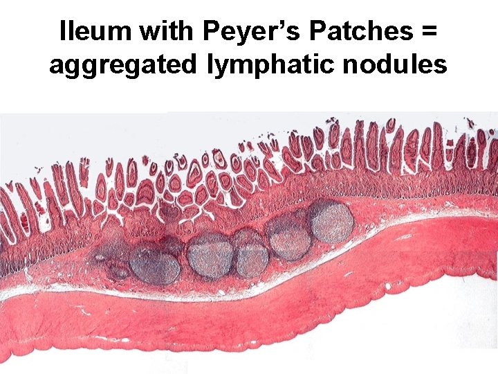Ileum with Peyer’s Patches = aggregated lymphatic nodules 