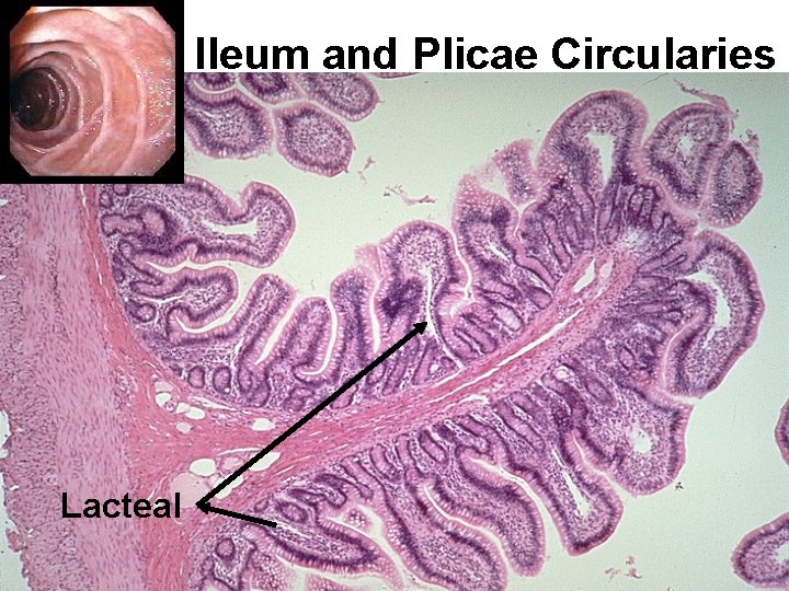 Ileum and Plicae Circularies Lacteal 