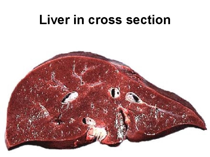 Liver in cross section 