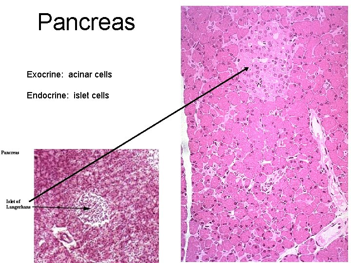 Pancreas Exocrine: acinar cells Endocrine: islet cells 