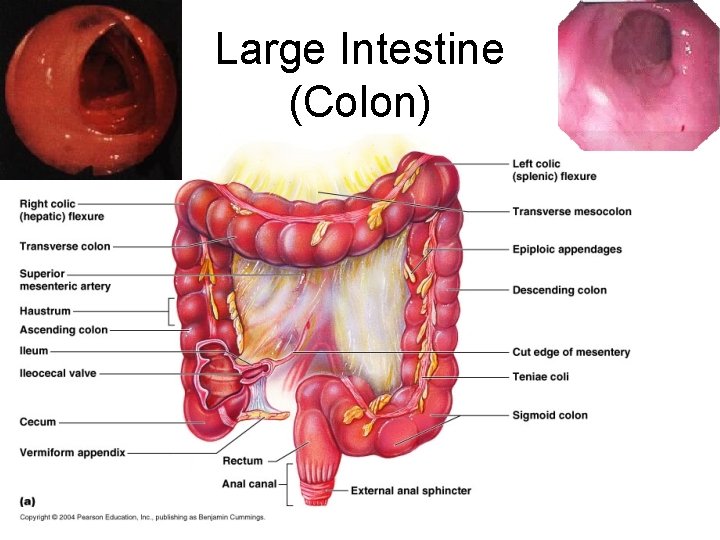 Large Intestine (Colon) 