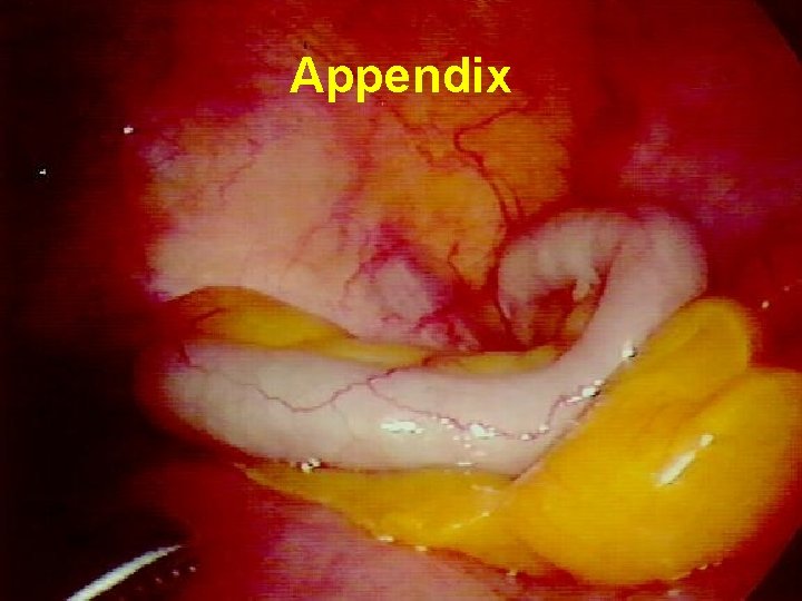 Appendix 