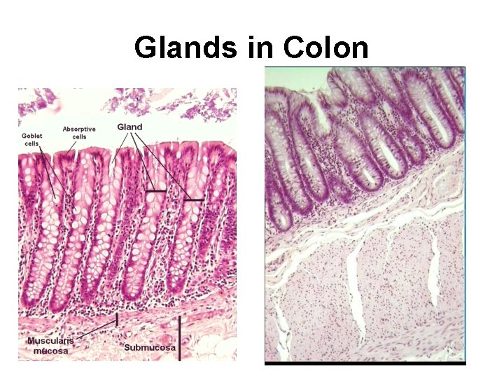Glands in Colon 