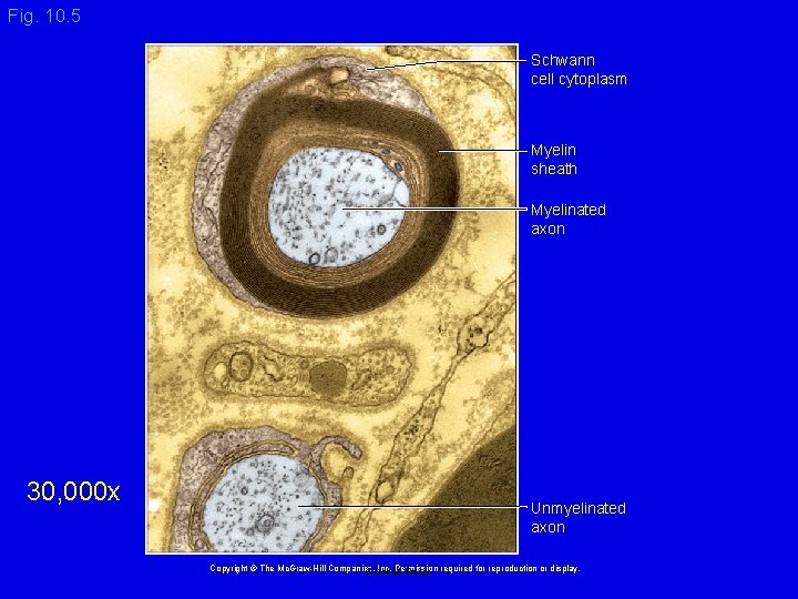 Fig. 10. 5 Schwann cell cytoplasm Myelin sheath Myelinated axon 30, 000 x Unmyelinated