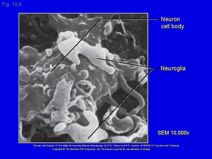 Fig. 10. 9 Neuron cell body Neuroglia SEM 10, 000 x Tissues and Organs: