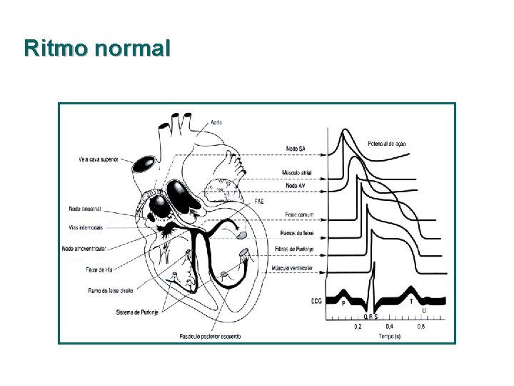 Ritmo normal 