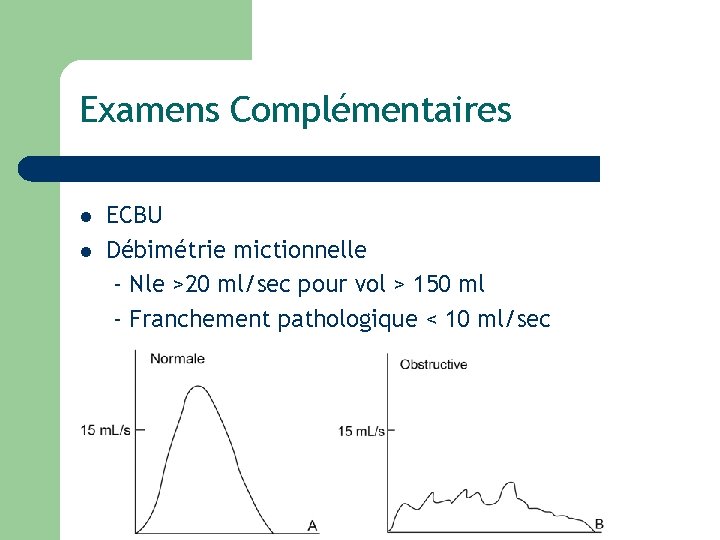 Examens Complémentaires l l ECBU Débimétrie mictionnelle - Nle >20 ml/sec pour vol >