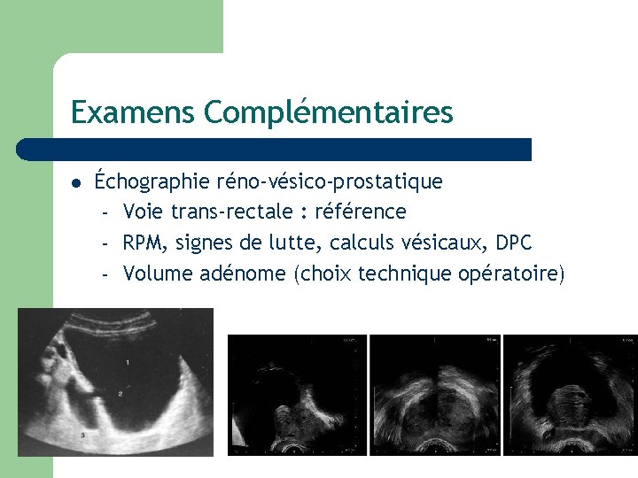 Examens Complémentaires l Échographie réno-vésico-prostatique – Voie trans-rectale : référence – RPM, signes de