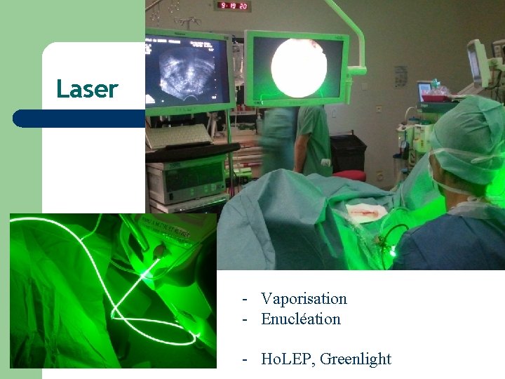 Laser - Vaporisation - Enucléation - Ho. LEP, Greenlight 