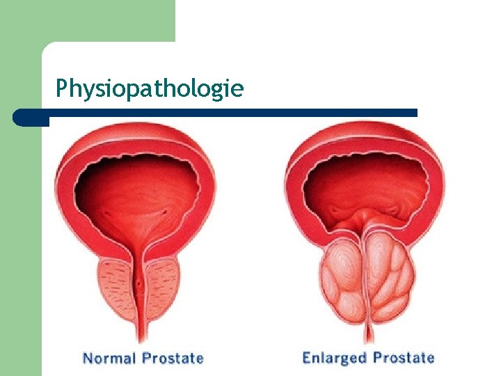 Physiopathologie 