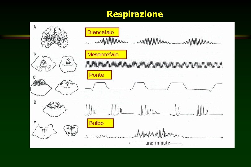 Respirazione Diencefalo Mesencefalo Ponte Bulbo 