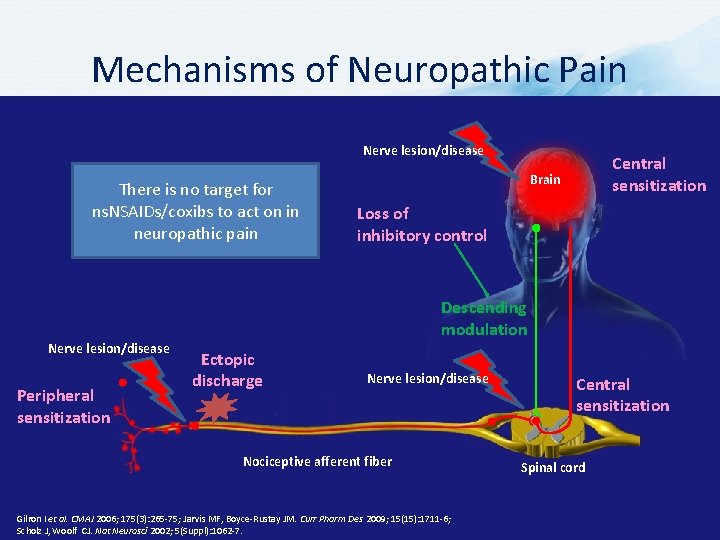 Mechanisms of Neuropathic Pain Nerve lesion/disease There is no target for ns. NSAIDs/coxibs to