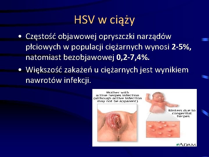 HSV w ciąży • Częstość objawowej opryszczki narządów płciowych w populacji ciężarnych wynosi 2