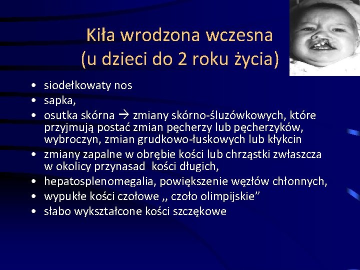 Kiła wrodzona wczesna (u dzieci do 2 roku życia) • siodełkowaty nos • sapka,