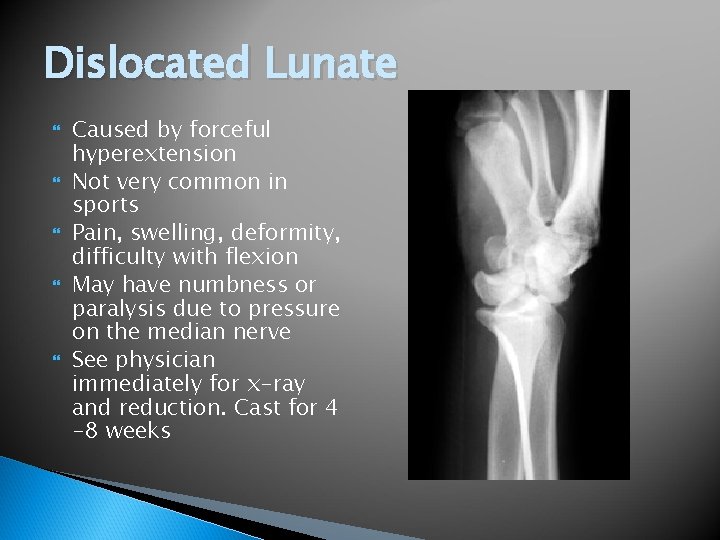 Dislocated Lunate Caused by forceful hyperextension Not very common in sports Pain, swelling, deformity,