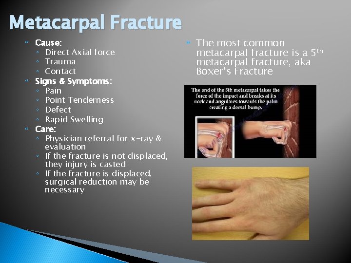 Metacarpal Fracture Cause: ◦ Direct Axial force ◦ Trauma ◦ Contact Signs & Symptoms: