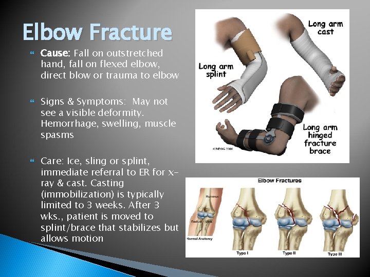 Elbow Fracture Cause: Fall on outstretched hand, fall on flexed elbow, direct blow or