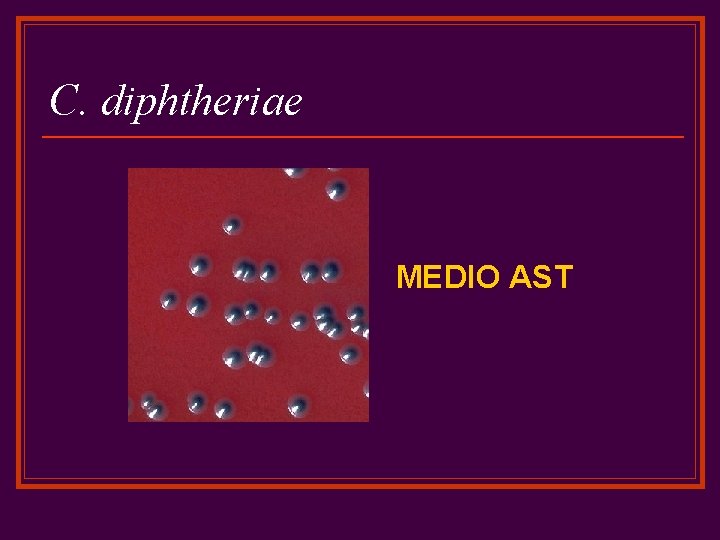 C. diphtheriae MEDIO AST 