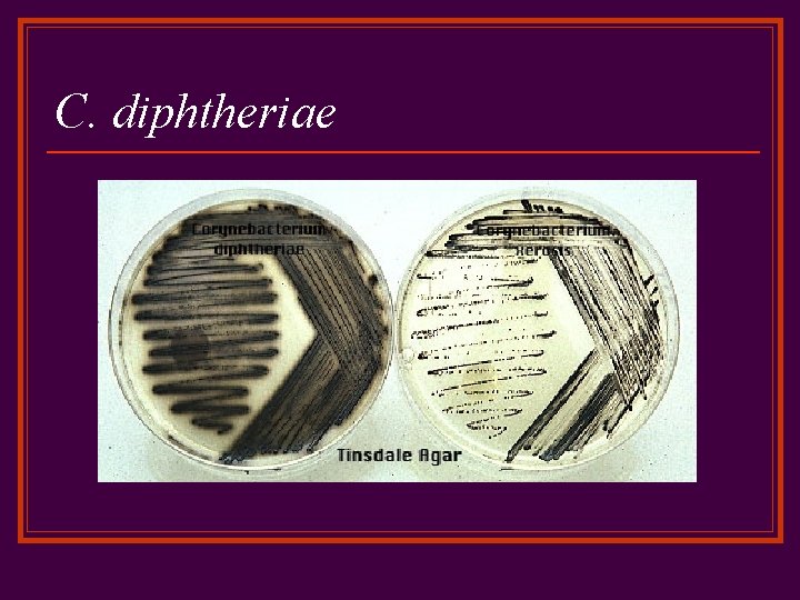 C. diphtheriae 