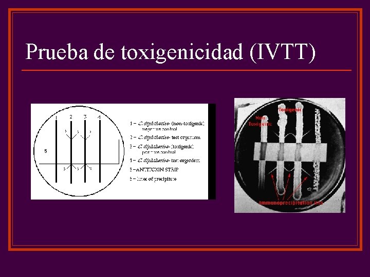 Prueba de toxigenicidad (IVTT) 