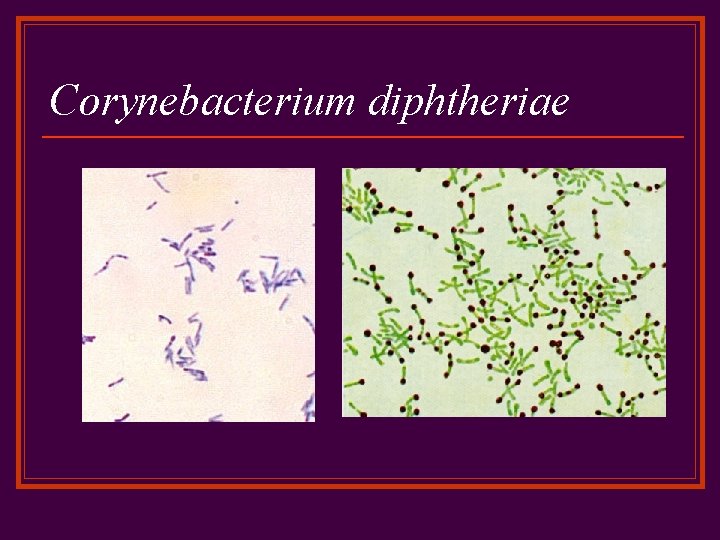 Corynebacterium diphtheriae 