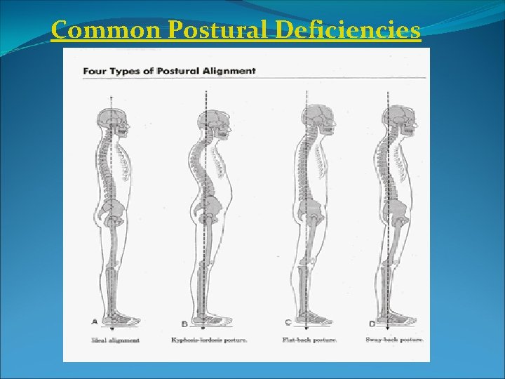 Common Postural Deficiencies 