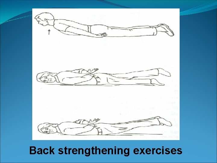 Back strengthening exercises 