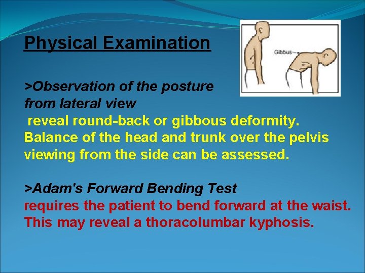 Physical Examination >Observation of the posture from lateral view reveal round-back or gibbous deformity.