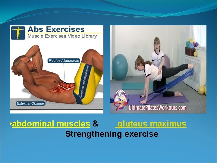  • abdominal muscles & gluteus maximus Strengthening exercise 