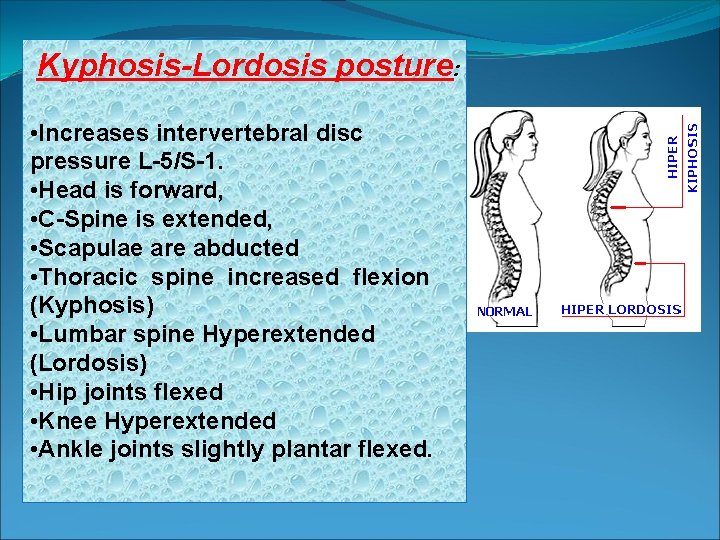 Kyphosis-Lordosis posture: • Increases intervertebral disc pressure L-5/S-1. • Head is forward, • C-Spine