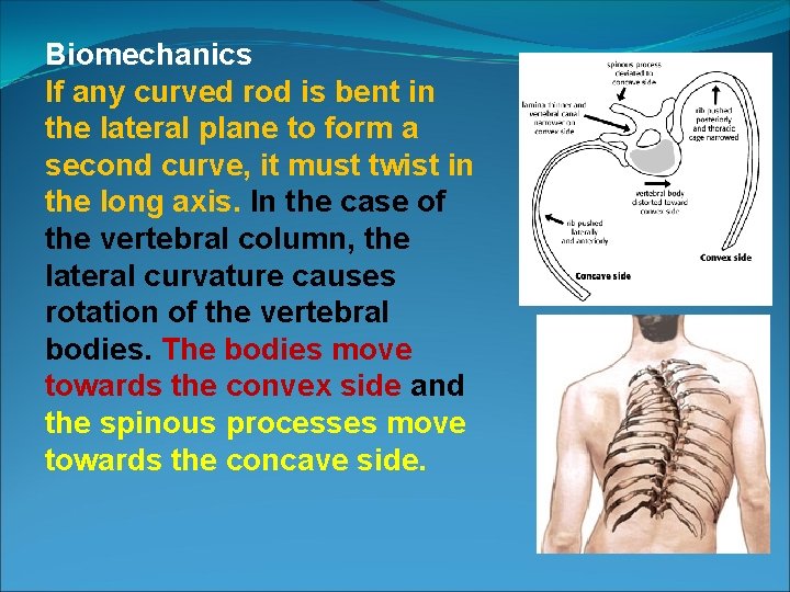 Biomechanics If any curved rod is bent in the lateral plane to form a