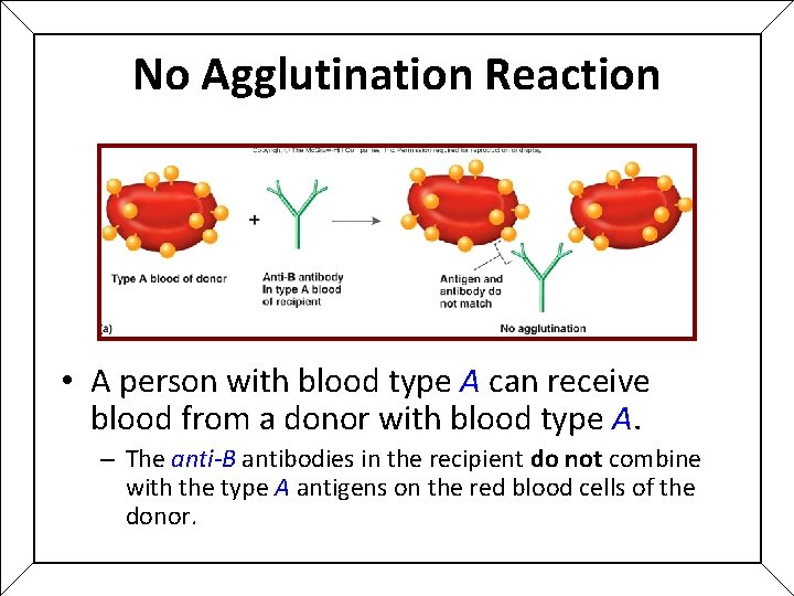 No Agglutination Reaction • A person with blood type A can receive blood from No Agglutination Reaction • A person with blood type A can receive blood from
