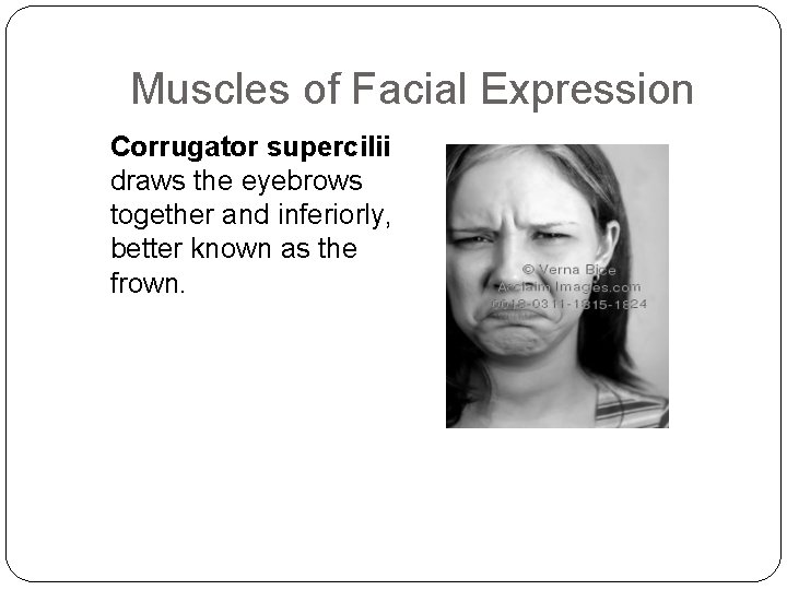 Muscles of Facial Expression Corrugator supercilii draws the eyebrows together and inferiorly, better known