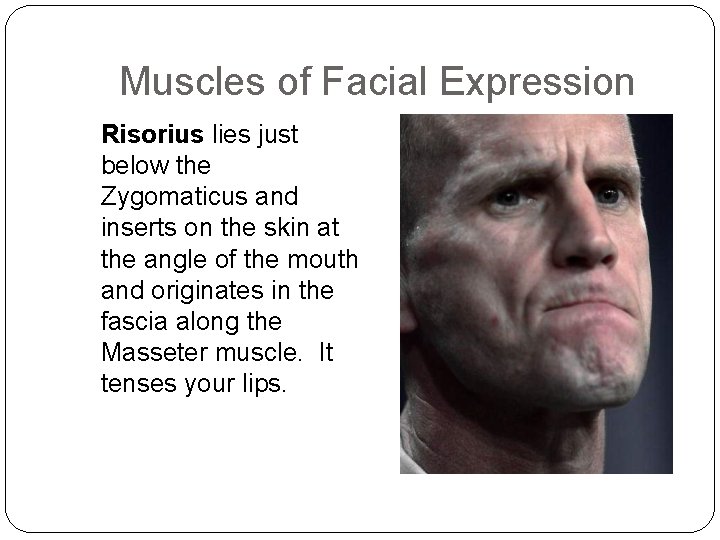 Muscles of Facial Expression Risorius lies just below the Zygomaticus and inserts on the